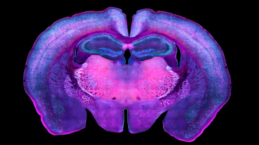 Fluorescence microscopy — coronal brain section (Hybrid Minds, neurotech)